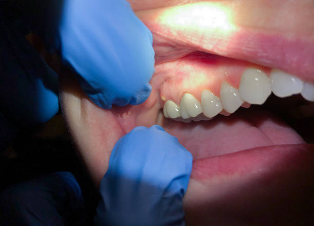 Best Emergency Tooth Extraction  in Potomac Park, CA